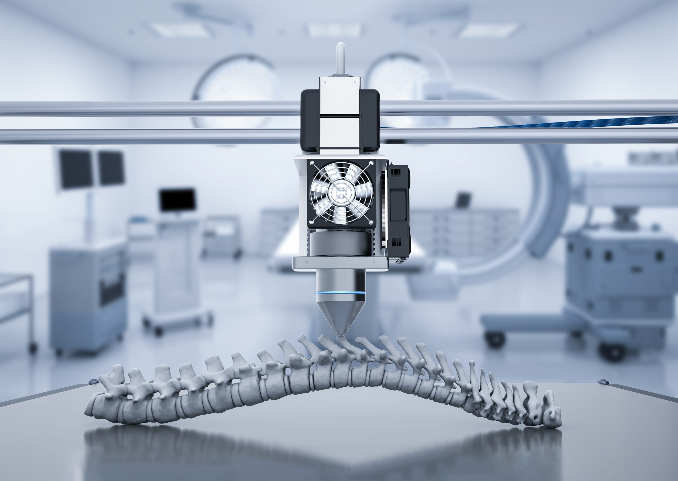 3d,Rendering,3d,Printer,Print,Prosthetic,Spine
